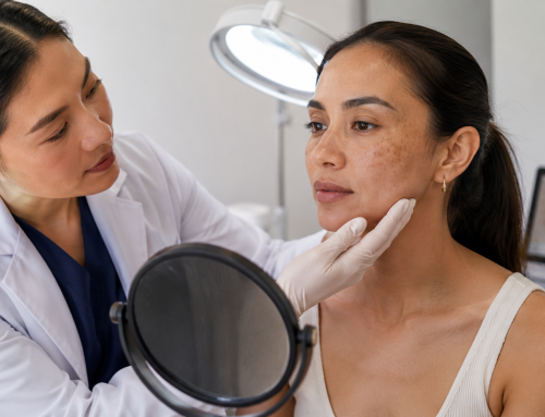 Sun Spots, PIH and Co. – Recognising and Treating Them Differentially